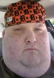 Can someone turn my hat the right way maybe give me less chins