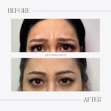 Enfuse Medical Spa™ (@enfusemedicalspa) · Instagram 照片和视频