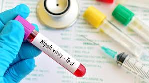 Nipah is a deadly virus that can be transmitted between people. 5 Fakta Soal Virus Nipah Penyakit Langka Yang Ditularkan Kelelawar