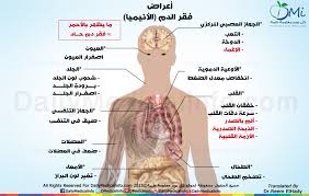 انفوجرافيك ما هى أعراض فقر الدم الأنيميا انفوجرافيك طبية كل يوم معلومة طبية Infographic Health Medical Information Infographic