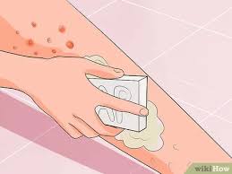 Moreover, when you haven't shaved your pubic hair for any long duration, likelihood of developing. How To Get Rid Of A Rash From Nair 11 Steps With Pictures