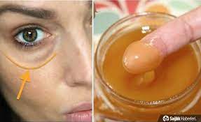 goz alti morluklari dogal olarak nasil gecer ne iyi gelir dogal gozler dogal guzellik ipuclari