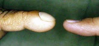 Image result for Digital Clubbing