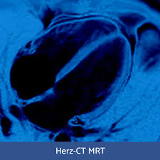 Myocarditides) is a general term referring to inflammation of the myocardium. Rfn Goes Online Wochenendkurs Herzdiagnostik Ct Mrt 1 2 Mai 2021 Rontgenfortbildung