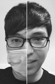 SARS-CoV-2 Isolation From Ocular Secretions of a Patient With COVID-19 in  Italy With Prolonged Viral RNA Detection