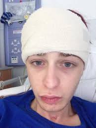 My flatmate smashed my head in with a hammer because I'm transgender