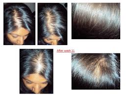 Are you worried about hair loss or poor hair growth? Nioxin Nioxin Hair System Kit 2 Noticeably Thinning Hair Review Beauty Bulletin Treatments Masks