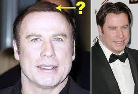 The hair in my toupee is real! we are focusing on bald or balding celebrities that are covering up without their natural hair. Pin On Hair