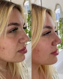Small Tweaks can make a big difference! 👃 Isn't it fascinating, that by  adding more product to the nose, we can make it appear smaller, this  confuses a lot of people, how