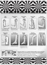 Ortho Glass Splinting Chart Www Bedowntowndaytona Com