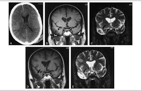 maging studies of a 49-year-old patient after a motor vehicle accident...
