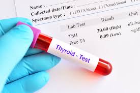 Patients With Mild Hypothyroidism May Not Need Treatment But