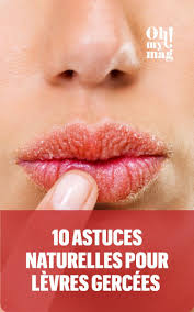 10 Facons D Hydrater Ses Levres Quand On A Plus De Baume Sous La Main Levre Levres Gercees Astuce Naturelle
