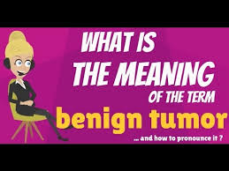 What Is Benign Tumor Benign Tumor Meaning And Definition Benign Tumor Signs Symptoms And Causes Youtube