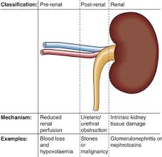 Image result for Postrenal Failure