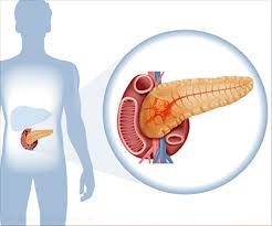 Normally, the liver releases a liquid called bile that contains bilirubin. Pancreatic Cancer All The Disease Its Diagnosis And Management