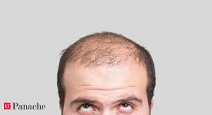 Some medical conditions cause eyebrow loss, such as alopecia totalis, alopecia universalis and alopecia areata where the body attacks the hair follicles, says burg. Baldness Say Goodbye To Baldness New Low Cost Tech Can Reactivate Hair Production The Economic Times