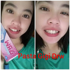 Pasta Gigi Drw Skincare Drw Skincare