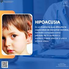 Hipoacusia se define como la disminución de la capacidad auditiva. Si has  notado que tu audición ha cambiado en los últimos días, te recomendamos  visitar a un experto. Consulta con los expertos