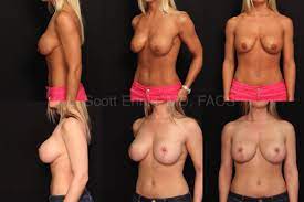 Breast Cup sizes nude 