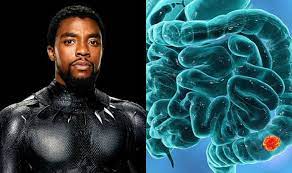 Polyps may be small and produce few, if any, symptoms. All About Colon Cancer Symptoms And Treatment Of Disease That Took Black Panther Aka Chadwick Boseman S Life