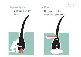 Most areas of the body can be treated with electrolysis, including the eyebrows, face, abdomen,. Electrolysis Hair Removal For Transgender Women 2pass Clinic