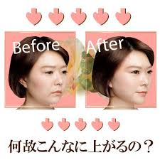 楽天市場 目の下 たるみ 解消 目の下のたるみ しわ たるみ ほうれい線 リフトアップ 瞬間リフトアップ シワ たるみ 解消 引き上げ ケア 小顔 美顔 目元 グッズ バンド テープ ベルト ヴィヴィアン マルシェ シワ たるみ 目の下 美顔