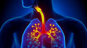 Boala pulmonara obstructiva cronica, sau pur si simplu bpoc, este un termen utilizat pentru un grup de boli pulmonare caracterizate prin obstructia cronica a cailor respiratorii din plamani. Ai Aceste Simptome Mare AtenÅ£ie E ApÄ La PlÄmani