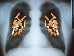 It can also look at your liver and adrenal glands. Ct Test For Hidden Lung Cancer Is Cost Effective But Not Covered For Many Likely To Benefit Harvard Health