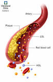Image result for icd 9 code for high lipids