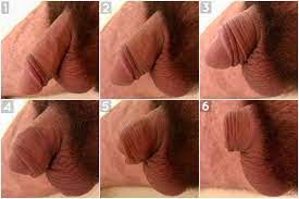 Flaccid penis pictures
