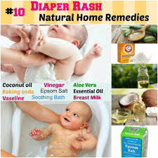 10 Home Remedies For Diaper Rash Protects And Nourishes Skin 1 Coconut Oil 2 Baking Soda 3 Vinegar 4 Vasel Coconut Oil Diaper Rash Diaper Rash Soothing Baby