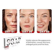 ORIENTLEAF Kojic Acid Soap, Turmeric Soap Bar, Fresh Citurs Scent, Gentle  for face and body with Vitamin C, Shea Butter, Retinol, Olive Oil, Collagen  (3 PACK) : Buy Online at Best Price