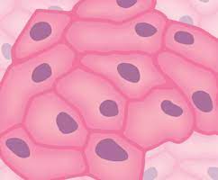 Resources and information on the latest treatments for mesothelioma, an indepth guide for patients, family members and friends. Mesothelioma Cell Types Epithelioid Sarcomatoid And Biphasic Cells