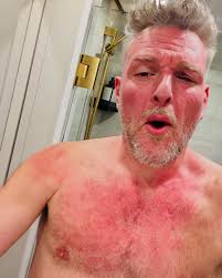 Pat McAfee shows the aftermath of his match with Gunther at Backlash