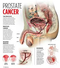 1 at what age should you get a prostate exam? Prostate