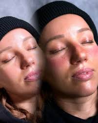 Enfuse Medical Spa™ (@enfusemedicalspa) · Instagram 照片和视频