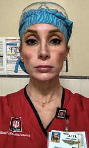 Nurses And Doctors Are Sharing The Graphic Effects Of Wearing Face Masks As  They Continue Fighting On The Front Lines Of The Coronavirus