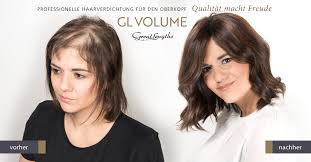 Frisuren männer lichtes haar haare sind einer dieser wichtigsten teile eines menschlichen körpers, dieser in gewissem metrik die persönlichkeit des einzelnen widerspiegelt. Gl Volume Eine Haarverdichtung Die Neue Massstabe Setzt Friseur Magdeburg