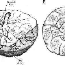 Saha s., biswas s., mitra d., adhikari a., saha c. Anatomy Of Human Placenta A Fetal Side The Amnion Umbilical Cord Download Scientific Diagram