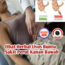 Maybe you would like to learn more about one of these? Obat Herbal Usus Buntu Sakit Perut Bagian Kanan Bawah Tanpa Operasi Shopee Indonesia
