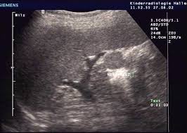 Accessory Spl Teaching Radiology Text