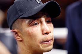 Julio Cesar Martinez Definitively Suspended For 9 Months