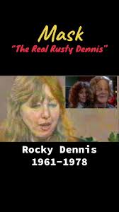 The Real Rocky Dennis: A True Story of Mask