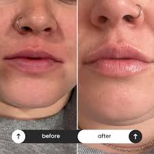 What are good doctors or medical aesthetic clinics in Riverview?