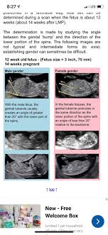 Help On 15 Week Gender Ultrasound February 2020 Babies Forums What To Expect
