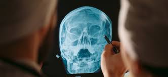 Image result for Sinus X Ray