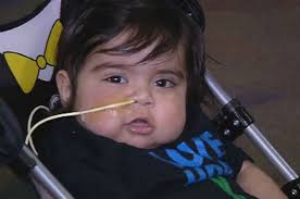 Birth Defect Forced Toddler to Receive 8 Organs in a Transplant