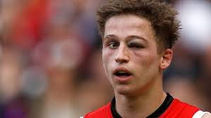 One-eyed Billings rolls with the punches