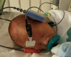 Maybe you would like to learn more about one of these? Universal Neonatal Hearing Screening Wikipedia